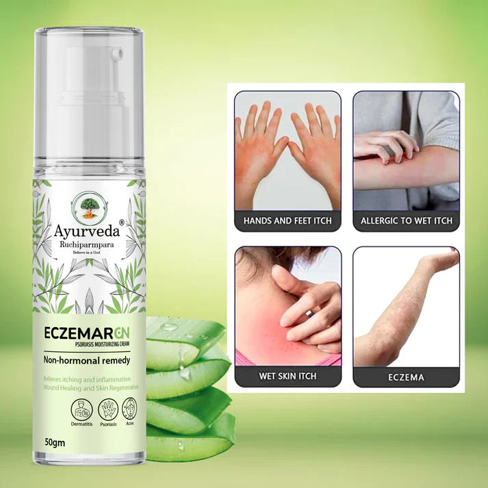 Eczemaron – Ayurvedic Psoriasis & Eczema Moisturizing Cream